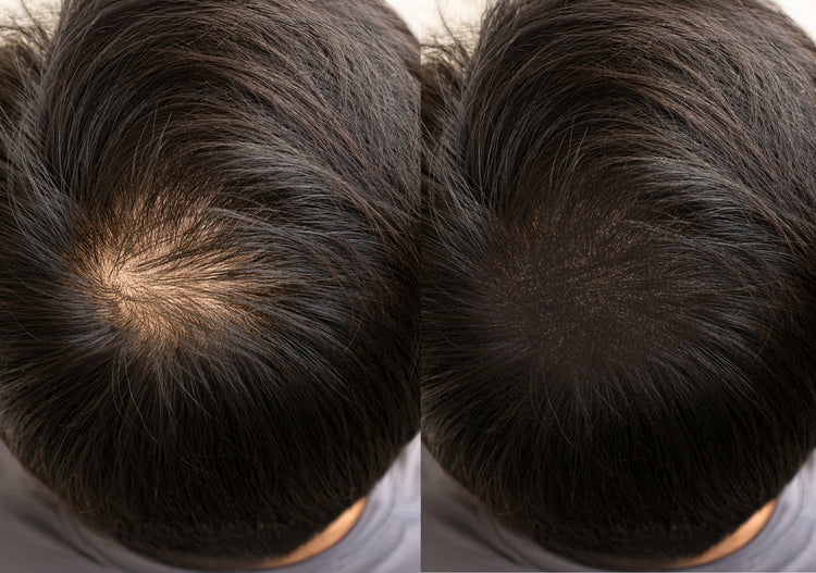 microhaarshading